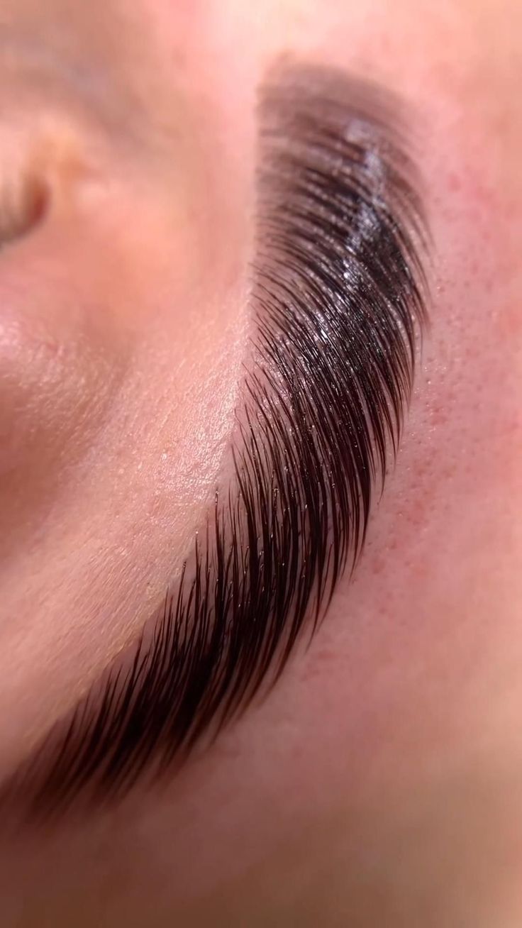 Brow 3