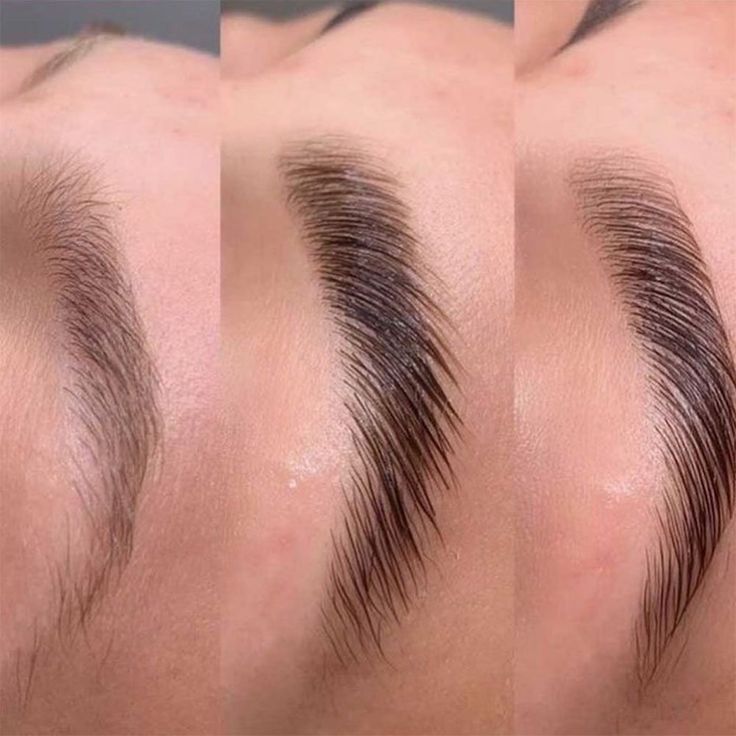Brow 2
