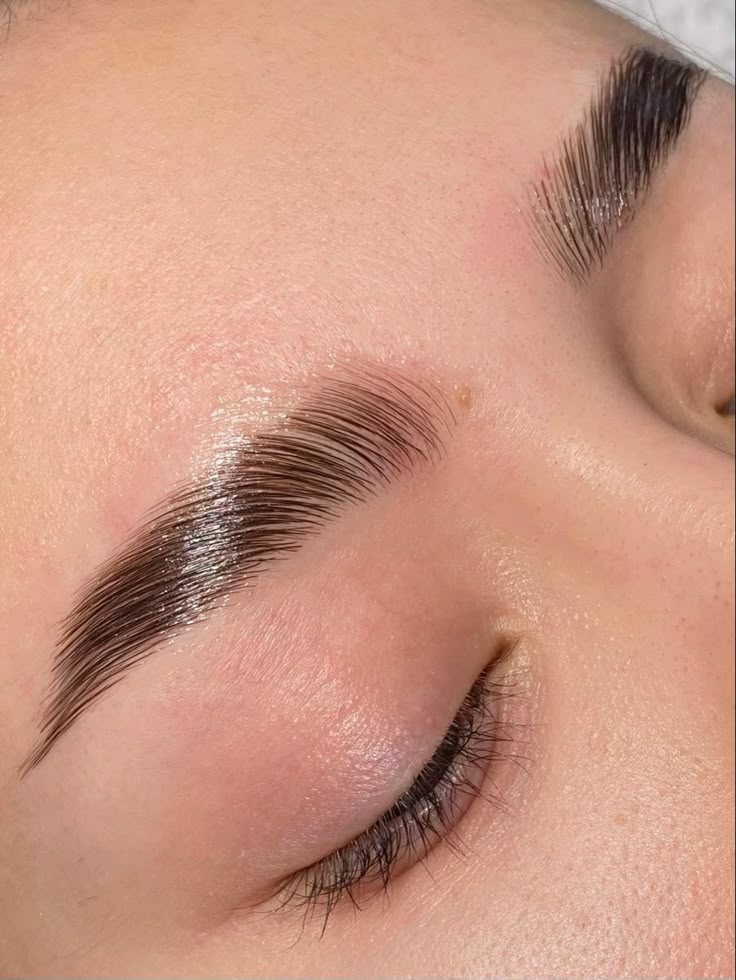 Brow 9