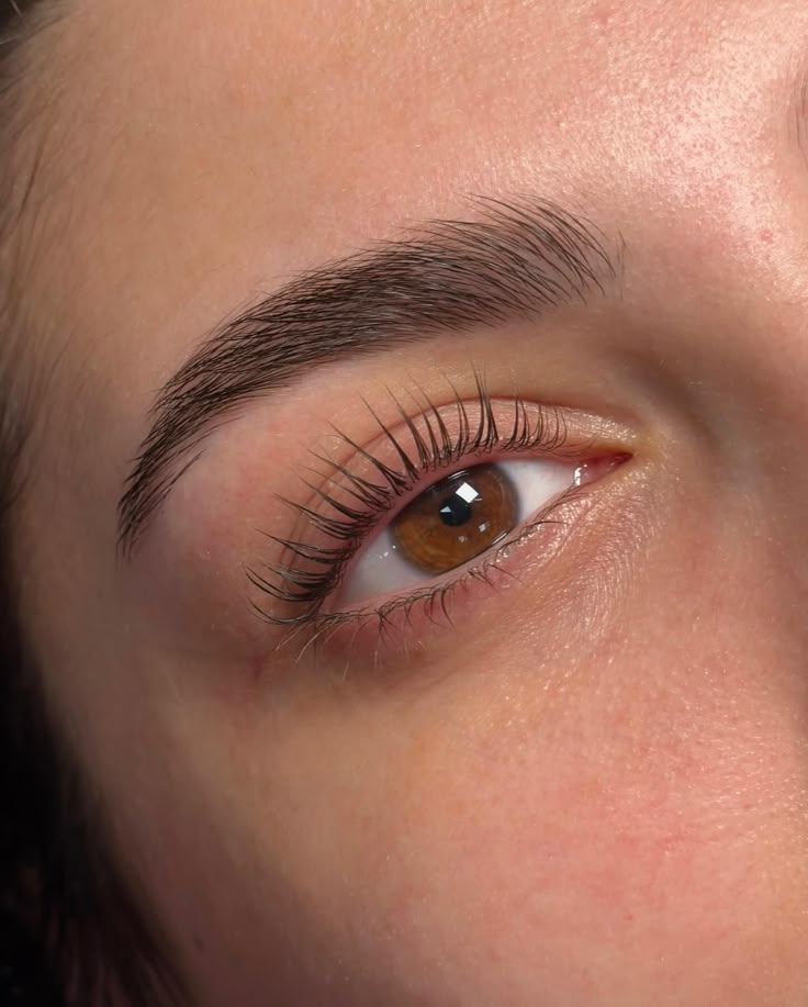 Brow 6